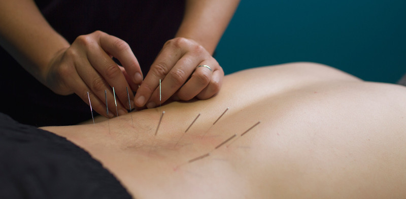 Dry Needling In Columbus, OH