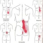 Lower Back Pain Trigger Point